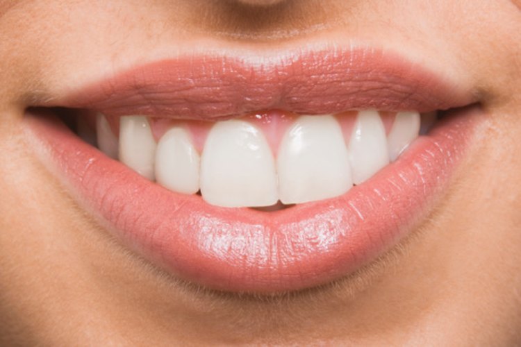 Una sonrisa sana es una sonrisa hermosa.