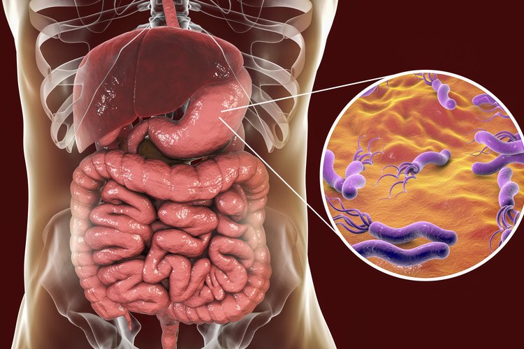 Helicobacter Pylori