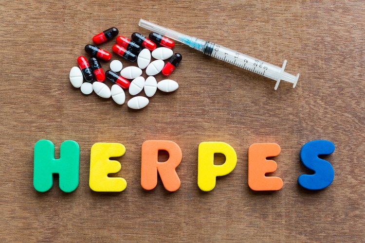 Tratamiento Herpes