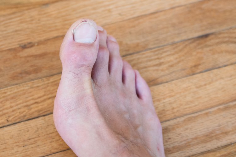 How To Fix A Split Toenail LEAFtv