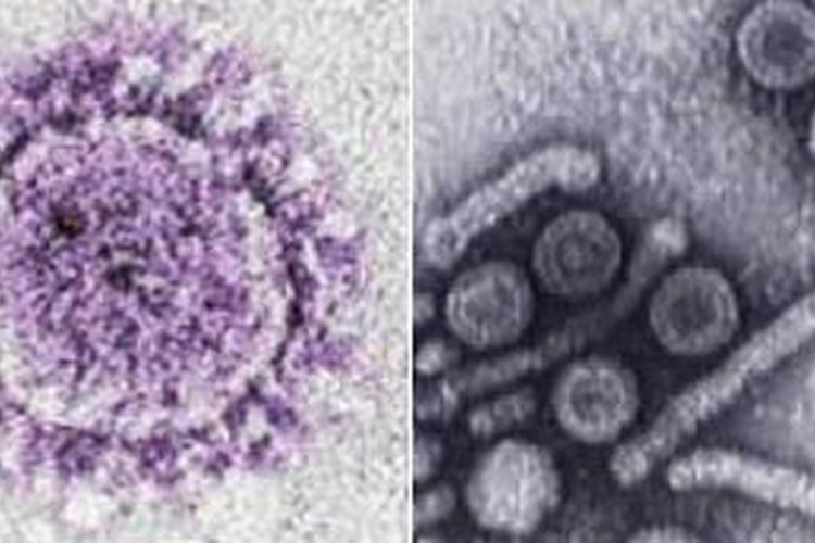 Parvovirus.