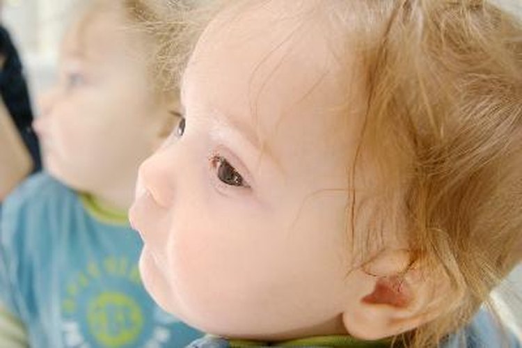 Las marcas de nacimiento pueden desaparecer a medida que el bebé crece.