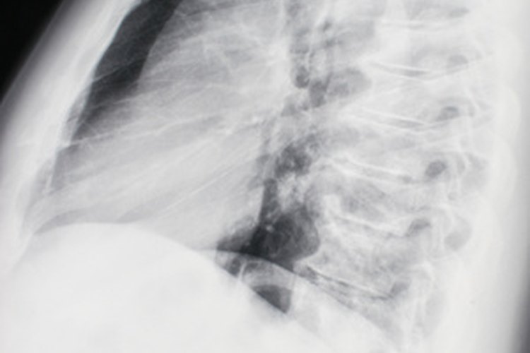 Tu veterinario puede ser capaz de ver un tumor de hígado mediante los rayos X.