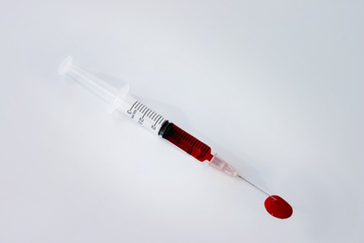 La sangre se estudia con un perfil bioquímico.