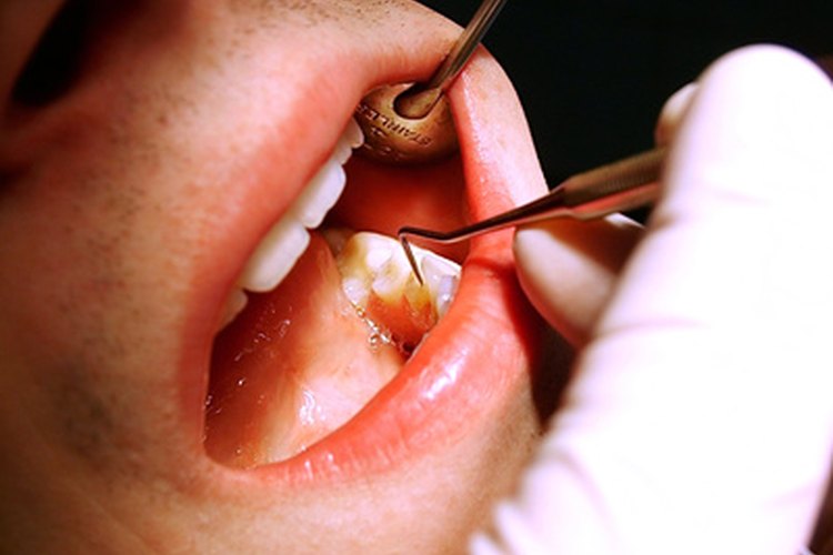 Los cirujanos dentistas llevan a cabo procedimientos simples y complejos de cirugía.