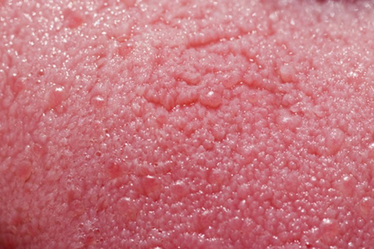 Lo que causa la lengua geográfica no está claro.