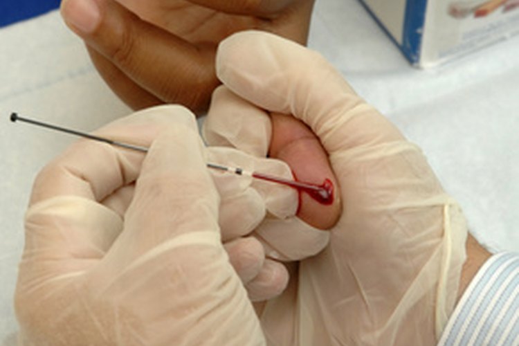 La neutropenia es una cantidad anormalmente baja de glóbulos blancos llamados neutrófilos.