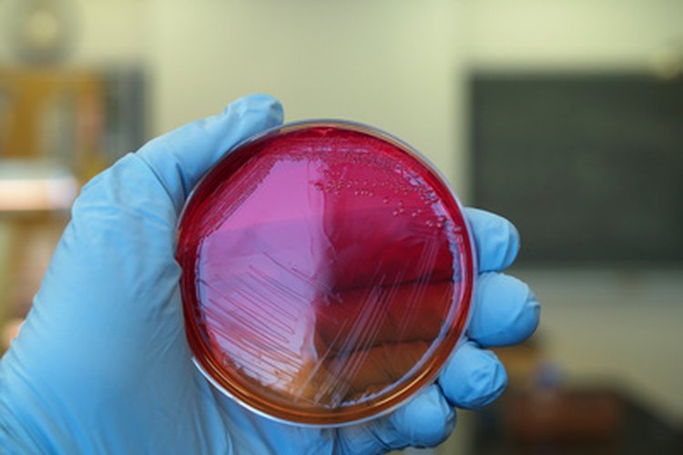 Las colonias de Bacillus subtilis crecen rápidamente en el agar.