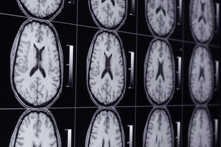 Los técnicos de rayos X pueden aumentar sus ingresos especializándose en áreas como la resonancia magnética.