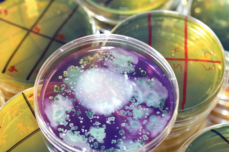 Algunos aditivos causan que el agar cambie de color en respuesta a ciertos tipos de crecimiento bacteriano.