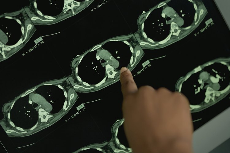 Resonancia magnética