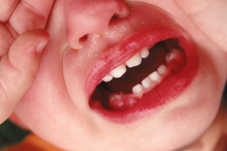 Un trapo frío puede ayudar a tratar el dolor por dentición de un bebé.