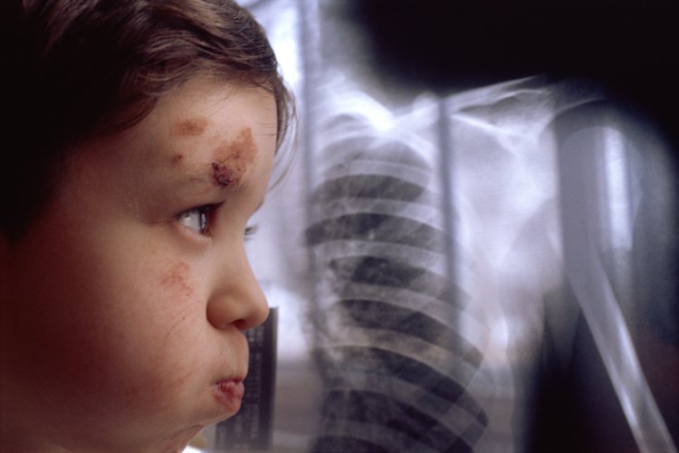 El abuso infantil y la negligencia son los peores ejemplos de una mala crianza.