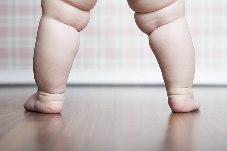 La obesidad en la infancia y niñez pueden aumentar el riesgo de obesidad en la etapa adulta.