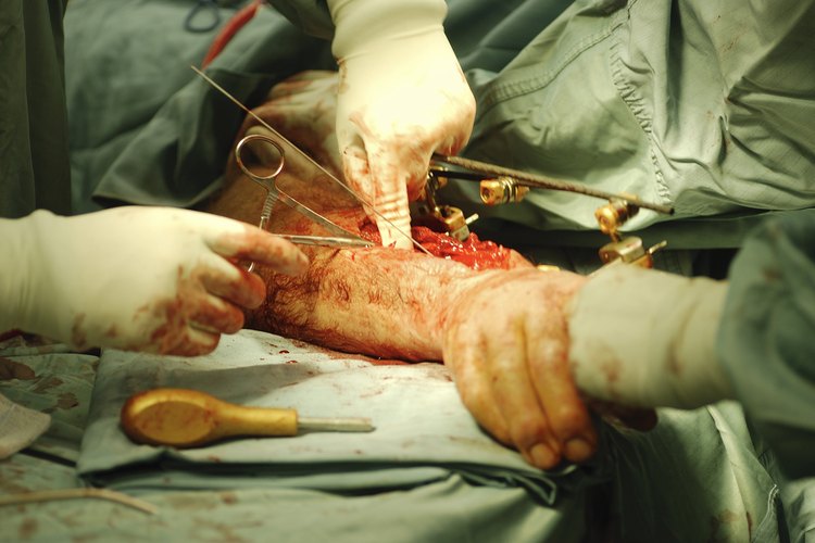Caerse de una ventana puede dar lugar a fracturas óseas, conmoción cerebral, hematomas y hemorragias, lesiones internas que requieren cirugía, cortes, raspaduras o puntos de sutura.
