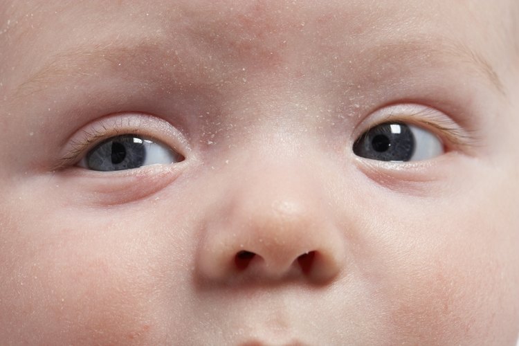 Por lo general es normal que el rostro del bebé no tenga la perfección de una foto.