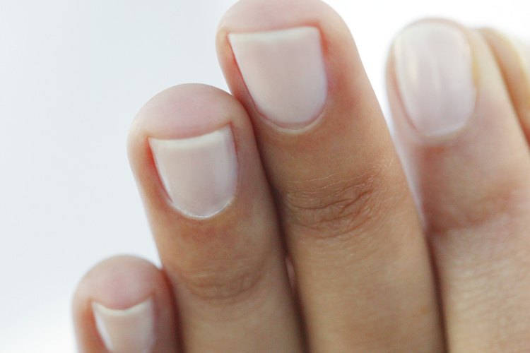 Las puntas de las uñas son propensas a astillarse.