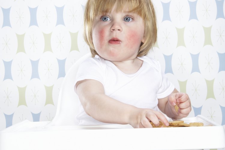 Darle a tu niño los alimentos adecuados puede ayudarle a aliviar su malestar.