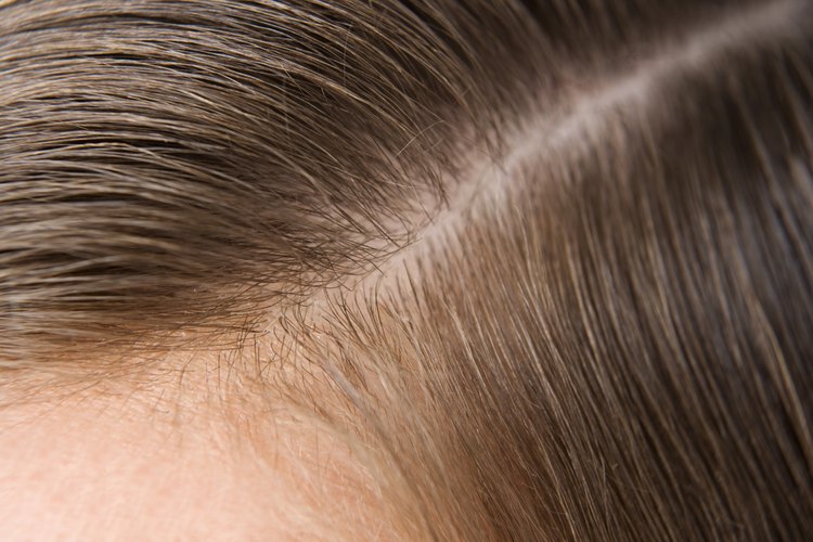 Primer plano de cabello y cuero cabelludo.