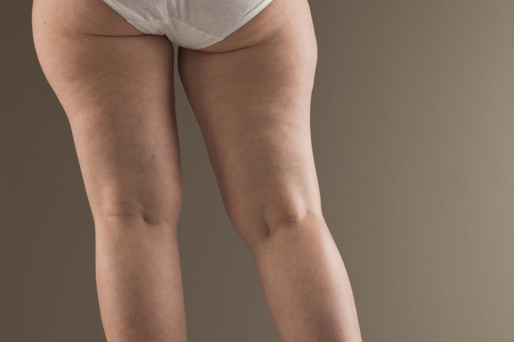 Elegir el traje de baño adecuado puede ayudar a disimular un cuerpo en forma de pera.
