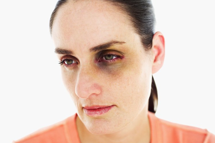 Emula un golpe real con sombra de ojos.