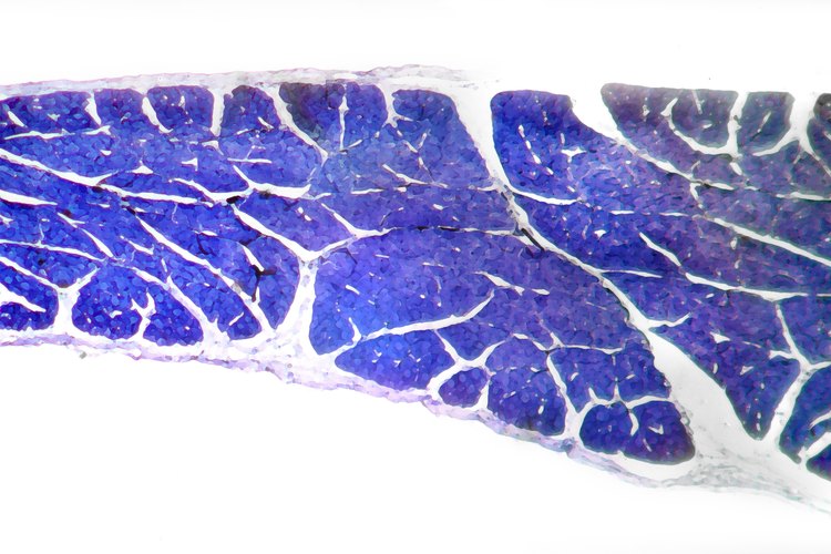 Teñido en azul, este tejido muscular muestra a la fascia profunda en blanco.
