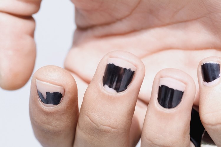 El esmalte de uñas quebrado es una molestia.