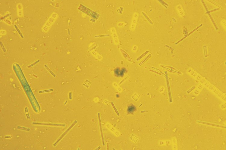 Las diatomeas son un tipo de fitoplancton de agua dulce.