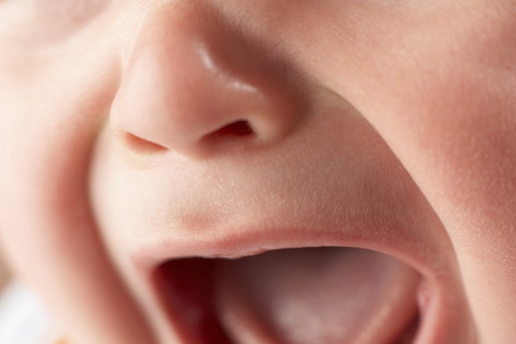 La dermatitis del pañal puede ser terriblemente incómoda para los bebés.