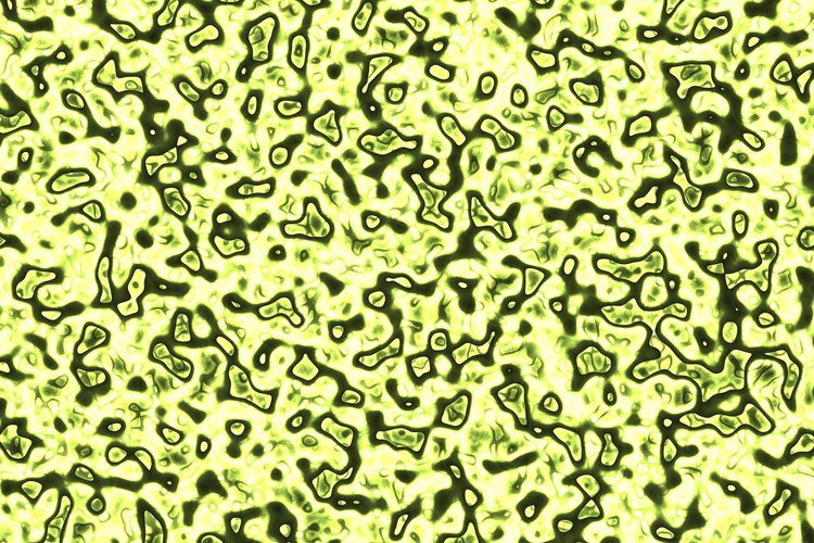 Vistos al microscopio, los critales de estruvita (fosfato amónico magnésico) son como fragmentos de vidrio.