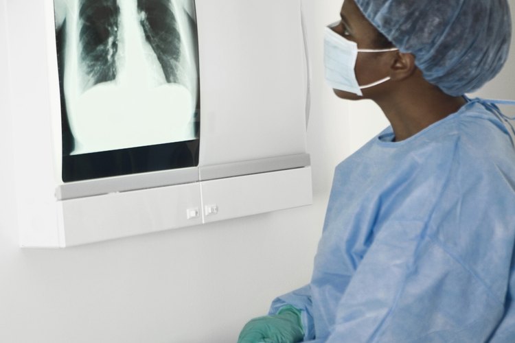 El cáncer de pulmón, la respuesta esperada al fumar, es la variable dependiente.
