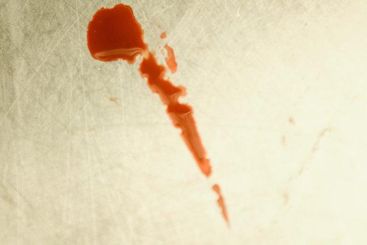 Eliminar la sangre de cualquier tipo de tela es un desafío.