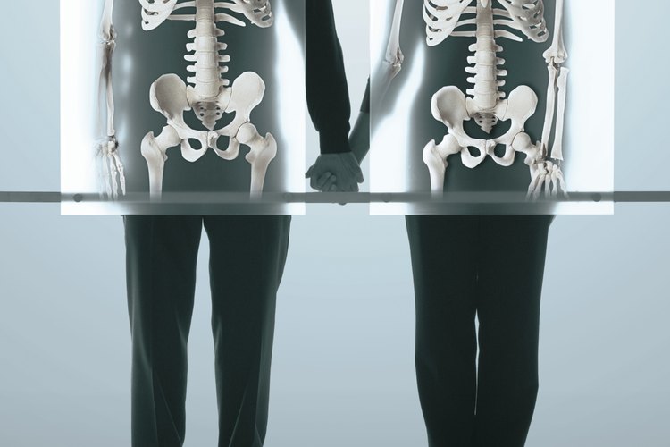 La osteoporosis juvenil generalmente está causada por la enfermedad subyacente.