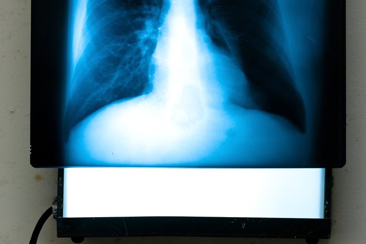 Los técnicos radiólogos proporcionan las imágenes de diagnóstico que necesitan los doctores.