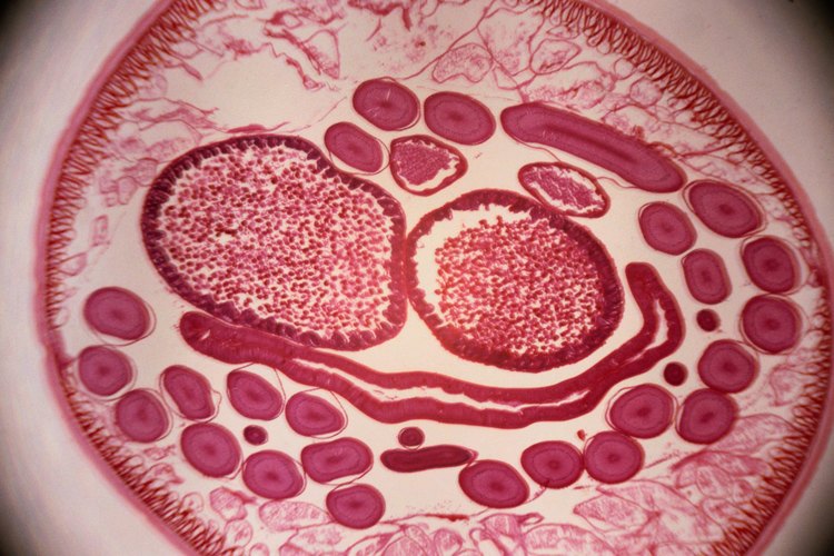 Algunos nematodos son tan pequeños que sólo pueden verse con un microscopio.