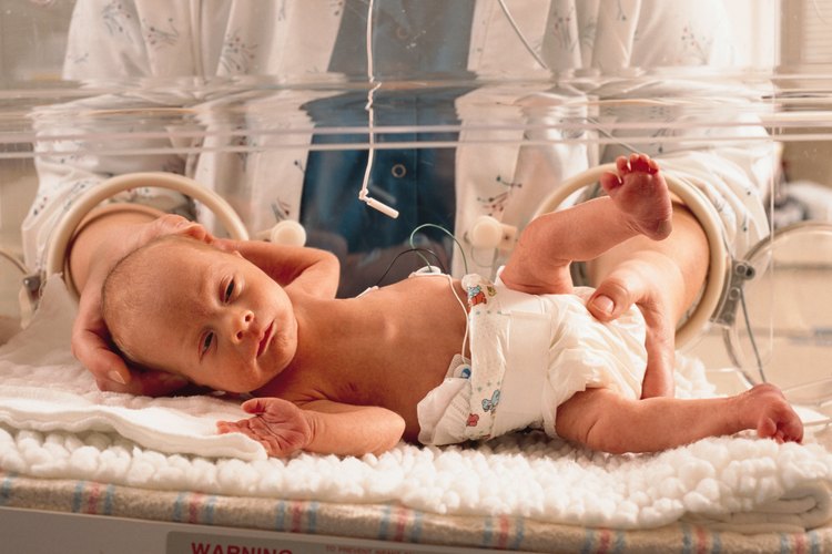 Los pulmones de un bebé prematuro, su sistema inmunológico, su sistema digestivo e incluso su piel están poco desarrollados.