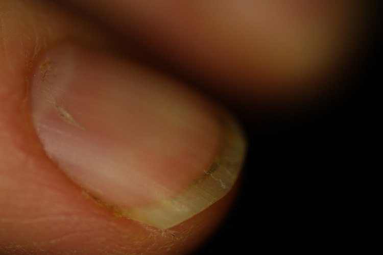 Ten hermosas uñas saludables.