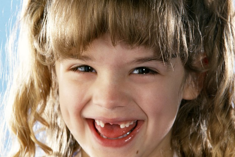 Es común que los niños desarrollen espacios entre sus dientes a medida que crecen. Por lo general, estas diferencias son sólo temporales.