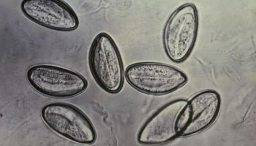 A magnified view of pinworm eggs.
