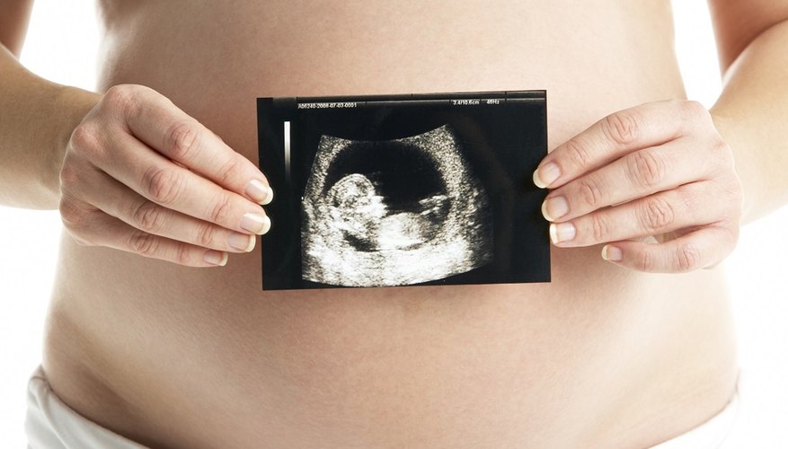 Counterfeit sonogram images make a fake pregnancy more believable.