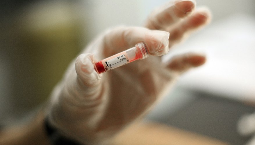 how-long-to-fast-before-a-blood-test-ehow-uk