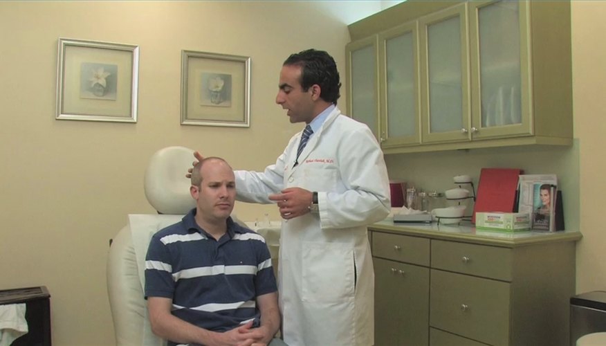 How to Stop Hair Loss for Men