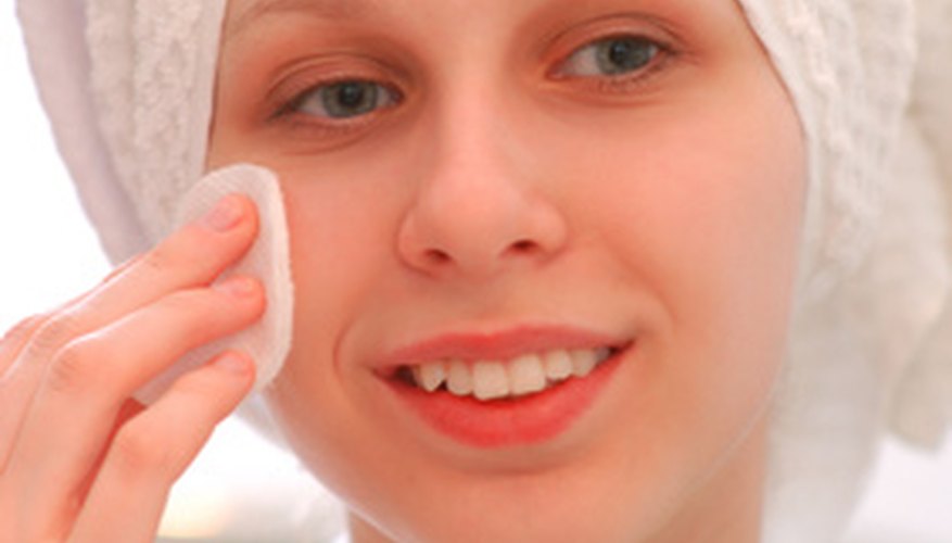 Squeezing inflected blackheads can lead to bruised skin.
