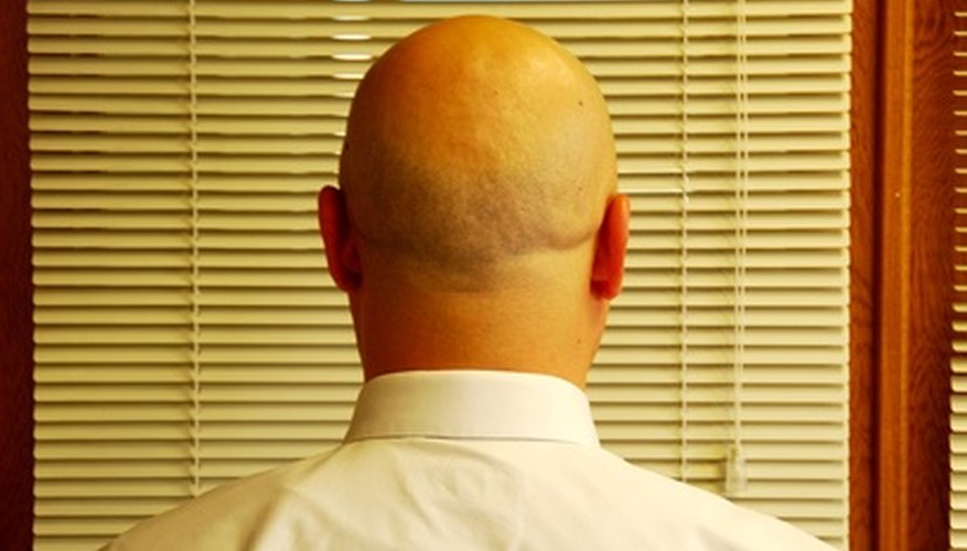 Custom skins can break the monotony of staring at 47's bald head.