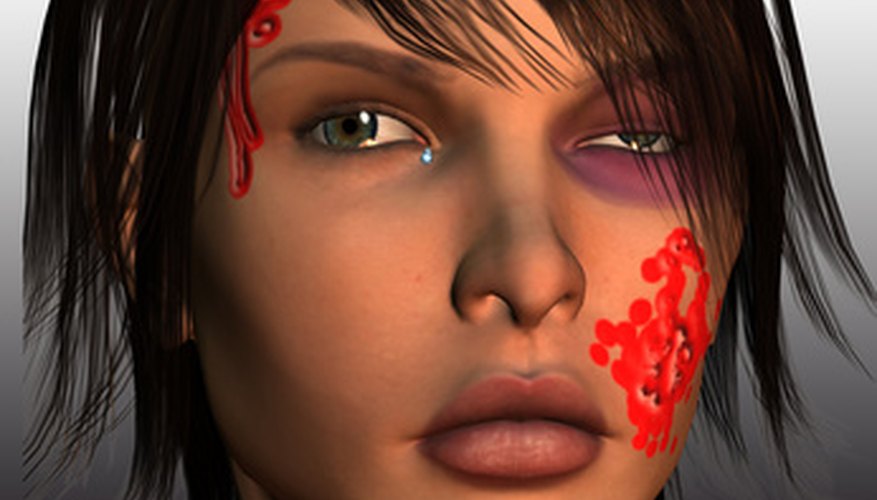 A graphic depicting a victim of domestic violence.