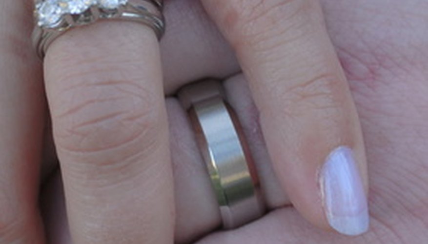 Wedding bands can leave indentations when worn daily for many years.