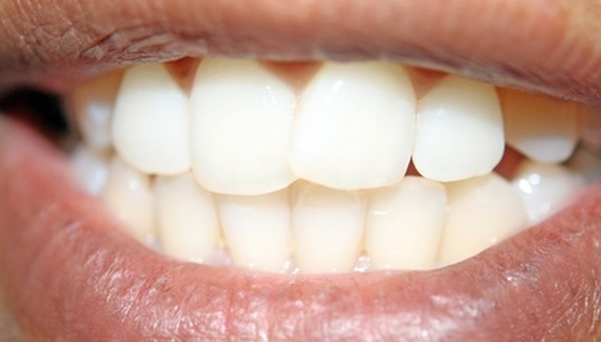 Calcium phosphates are found in tooth enamel, bone, and some kidney stones.