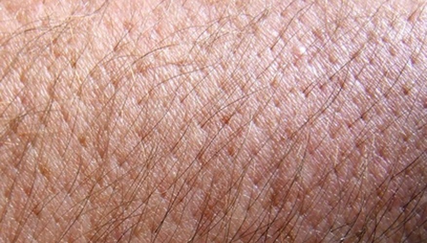 Pores can become more open after waxing.