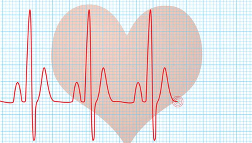 The mural endocardium refers to lining in the heart muscle