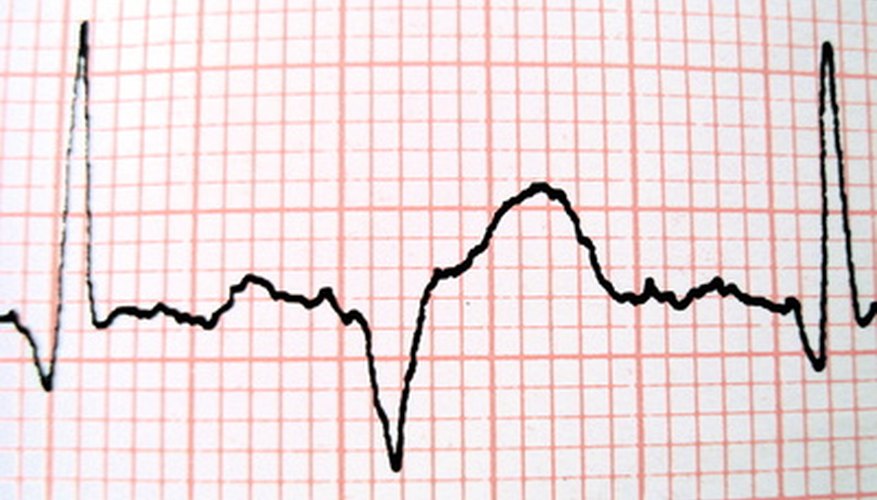 High school students can experiment to determine how listening to a heartbeat affects their own heartbeats.